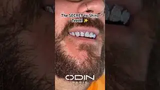 Glow Up with Full Iced-out Teeth Grillz! #shorts #grillz #moissanite