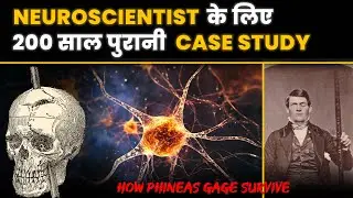 लोहे की Rod हुई आर -पार कैसे बचा Phineas | Phineas Gage Case Study Psychology in Hindi