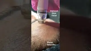 Diamond Glow Facial #diamondglow #vitaminc #vitamincserum #facials #rosemarynettogomes