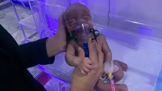 Why This Newborn Needs Nebulization 😮👶 | Breathing Support #Nebulization #NICUBaby #NewbornCare
