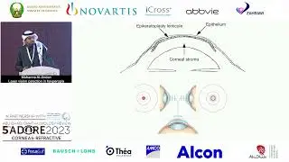 LVC Correction in Hyperopia - Mohanna Al Jindan