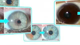 Eyecos Clinic | Work Station eyes color change