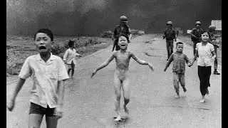 Napalm girl is horribly wounded, but she is still standing, and so must I