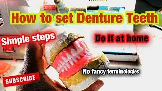 How to Set Dentures Teeth