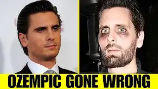 Shocking Ozempic Transformations of Celebrities | Then and Now 2026