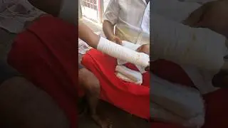 Best place for Bone fractures🤯👉#trending#youtubeshorts#shortsfeed#viral#tamil#minivlog