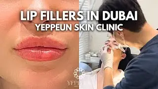 Lip Fillers in Dubai | Yeppeun Skin Clinic #Dubai #Dubaibeauty #Kbeauty #SkinClinic #LipFiller #Lips