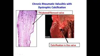 CVS Practical Pathology Slides Dr - Hegazy 2025