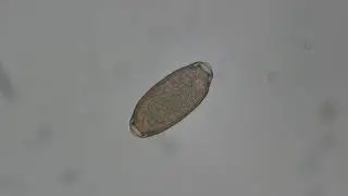Avian Capillaria