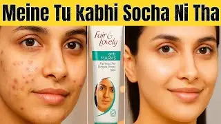 Fair & Lovely Anti Marks Cream Review | Kya Ye Worth It Hai For Acne Scars?