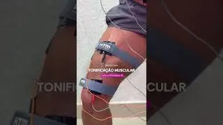 Protocolo de tonifica&ccedil;&atilde;o muscular | Stimulus-R da HTM