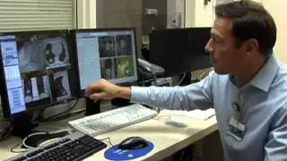 Stereotactic Body Radiation Therapy (SBRT) - Cancer Treatment