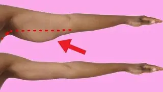 Ein effektives Workout gegen Winkearme speziell f&uuml;r Frauen!