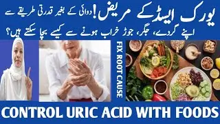 8 Foods That Flush Uric Acid Naturally /Uric Acid Treatment /Listen Your Body