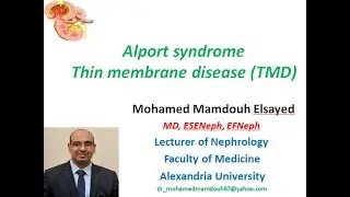 Alport syndrome, Thin basement membrane disease (TBM)