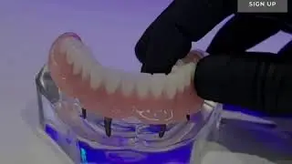 Life-changing Full Mouth Dental Implant Snap-on Dentures  - No more loose dentures. Guaranteed!