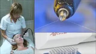 Аппарат Affinite