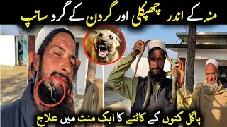 Talented Pakhtoon Story ۔ منہ کے اندر  چھپکلی اور گردن کے گرد سانپ