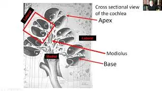 Auditory Disorders and Occupational Health Dr  Vermiglio part 1 section I and II