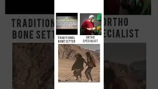 Traditional Bone Setter vs Orthopaedic specialist