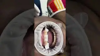 Marie's New Smile with Aleriom  #affordabledentalcare #smilerevolution