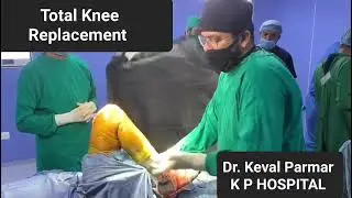 Total Knee Replacement | Dr. Keval Parmar | KP Hospital