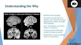 Managing Challenging Expressions in Dementia Care: Compassionate Strategies for Caregivers
