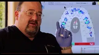 T-Scan for Dentists