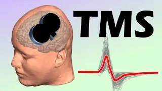 Transcranial magnetic stimulation (TMS) over the motor cortex