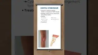 Hoffa syndrome explained