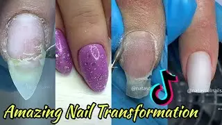 💖Satisfying Nail Care || Amazing nail Transformation Compilation