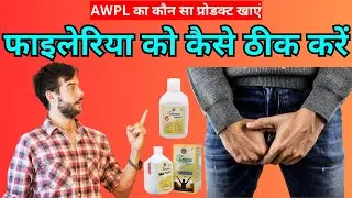 How to cure Filariasis | failaria kaise Thik Kare | Thunderblast Immunodoc | Striker Guru Ji