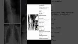 General Surgical Abdominal X-ray Series #Barium Swallow #shortsfeed