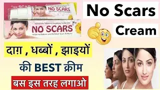 Use No Scars Cream Like This | Cure More Than 10 Skin Problems At Just Rs 263