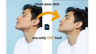 Photoshop Retouching Trick | Skin Editing in Photoshop | Acne & Spot Removal Tutorial