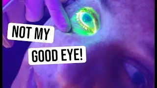 Designer Injures Her Good Eye | My Experience with a Corneal Abrasion