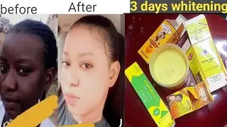 How To Promix a Strong Whitening Body Lotion To get 4 to 5 shade skin whitening using lemonvate tube