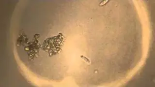 Leben im Wassertropfen - HD Mikroskop Video