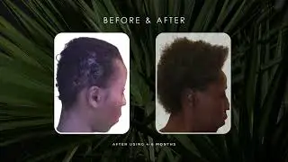 Sempre  Hair Growth Foam Transformation