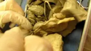 Fetal Pig Dissection: Urogenital System (male)