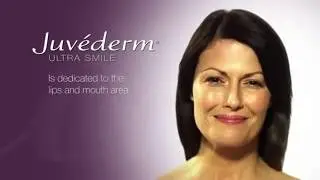 Injekcijas ar Juvederm Smile