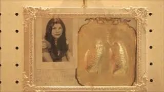 La Madonna del Pozzo e gli Ex Voto