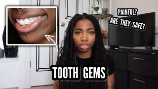 are tooth gems 𝙧𝙚𝙖𝙡𝙡𝙮 that bad for your teeth?