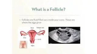 Egg Donor Chat Webinar