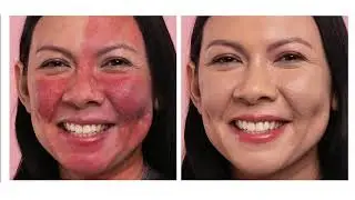 How to: Reduce the Look of Redness with Foundation Ft. IT Cosmetics | Sephora