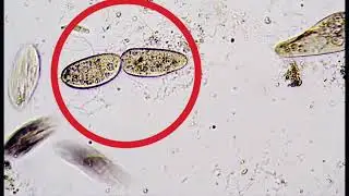 World through Microscope 675x | binary fission in paramecium | asexual reproduction in paramecium |