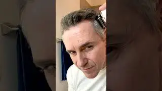 How to use The Hair Growth Kit