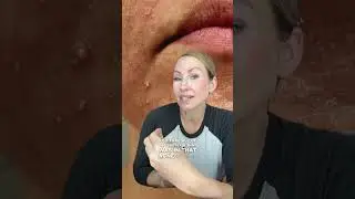 Micro needling at home can be safe as long as you know what you&rsquo;re doing