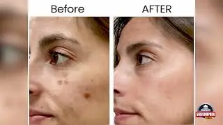 Exclusive program with certified cosmetologist & skin specialist,featuring advanced skin treatments