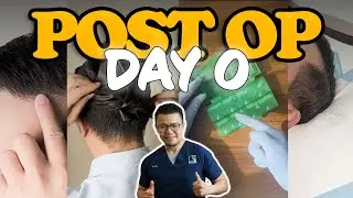 Day 0 &mdash; Hair Transplant Procedure Day